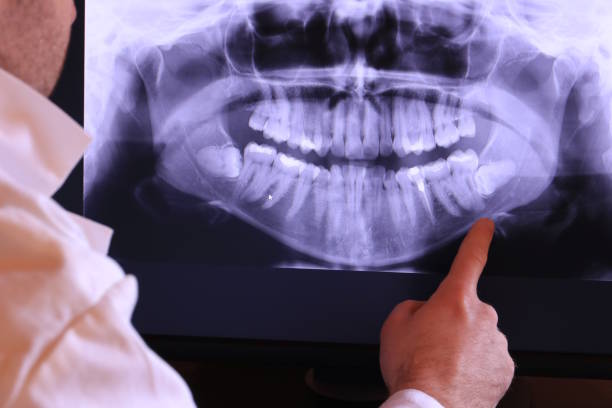 Best Pediatric Emergency Dentist in Saratoga Springs, UT